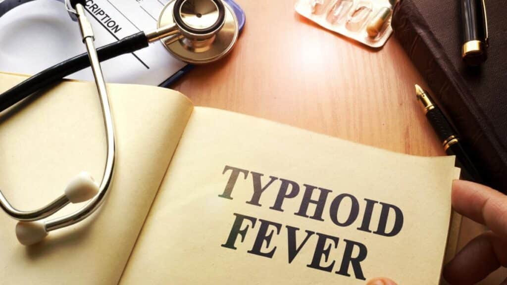 Typhoid - DP